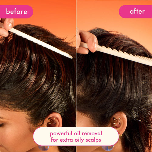 Load image 1 in gallery view. AMIKA Perk Up Ultra Oil Control Dry Shampoo Before After