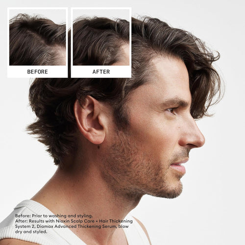 Load image 1 in gallery view. NIOXIN Scalp + Hair Shampoo Natural Untreated Hair 2 Before After