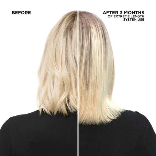 Load image 1 in gallery view. REDKEN Extreme Length Spring Duo